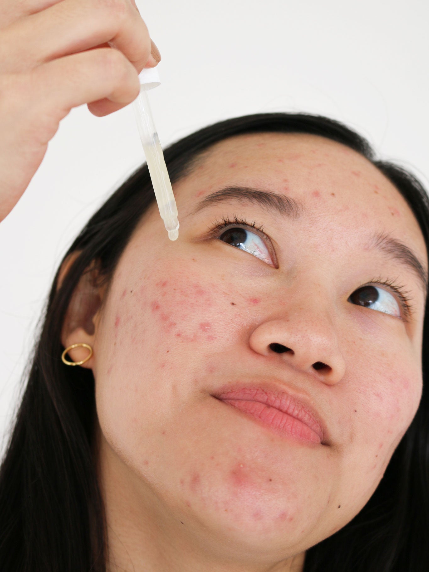 sm-image-f873704da1d2aeb212fa8a19 postbiotic acne serum